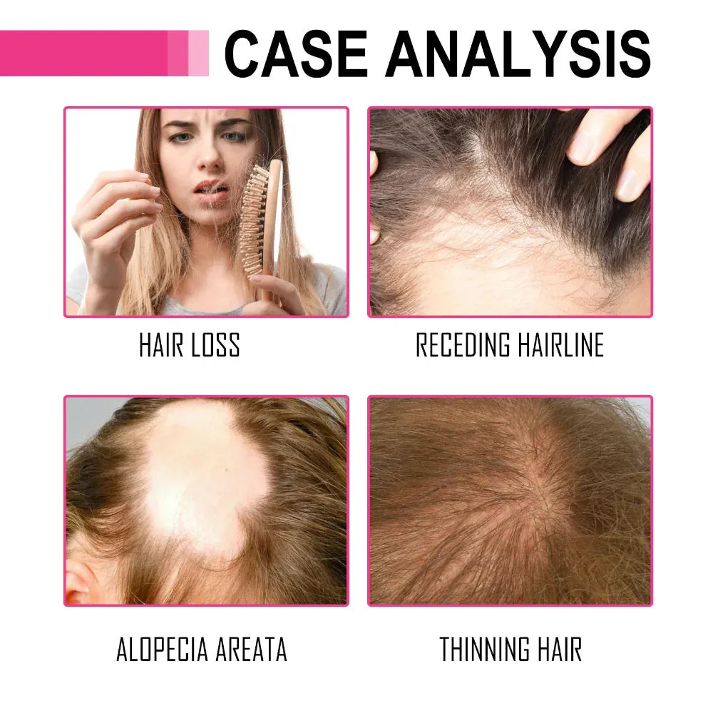 Huile capillaire essentielle marocaine pour hydrater et réparer les cheveux secs et crépus