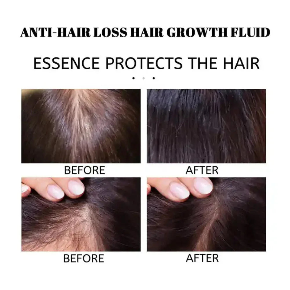 Huile antichute et de repousse des cheveux