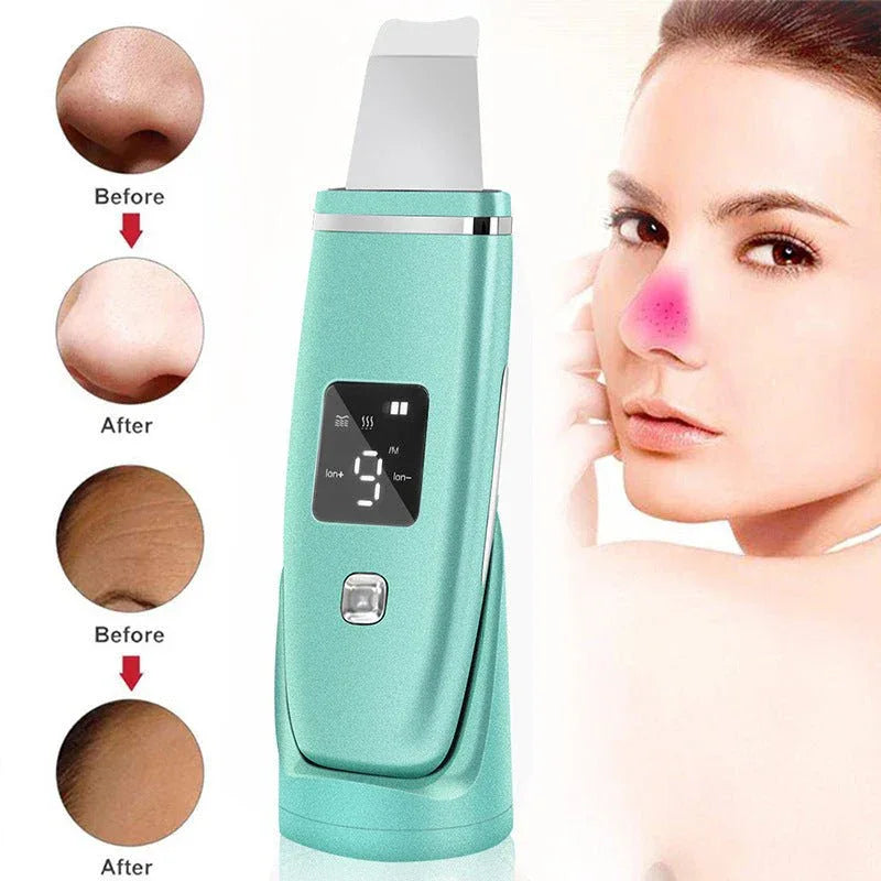 Ultraschall-Vibrations-Mitesser- und Akne-Entferner Tiefenreinigender Gesichtsreiniger mit Peeling-Spatel