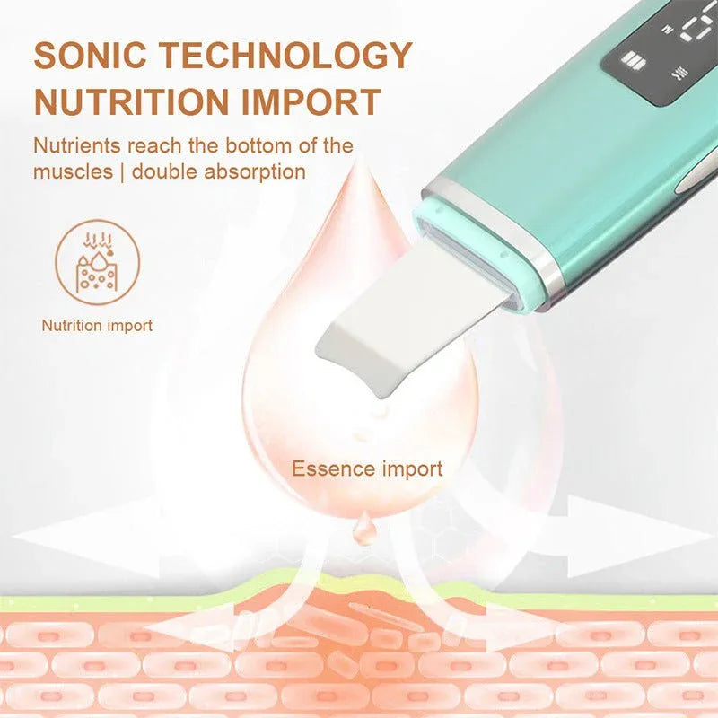 Ultraschall-Vibrations-Mitesser- und Akne-Entferner Tiefenreinigender Gesichtsreiniger mit Peeling-Spatel
