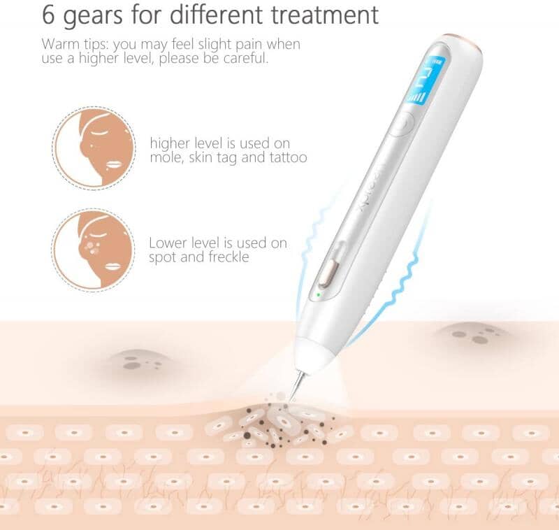 ⭐ XPREEN Spot Eraser Pro – Hochwertiger Beauty-Pen für kosmetische Hautverbesserung